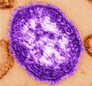 virus rougeole